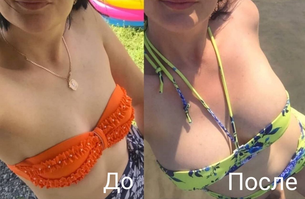 thumb2